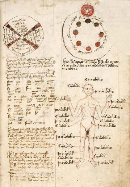 Illumination. In the bottom right quadrant of this page, a bald, nude person is covered in red slashes and holes. A red line leading from each connects to text that reads “curabiles” or “incurabiles”. Two circular diagrams are at the top of the page, and a column of brown text fills in the area beneath the left-hand diagram.
