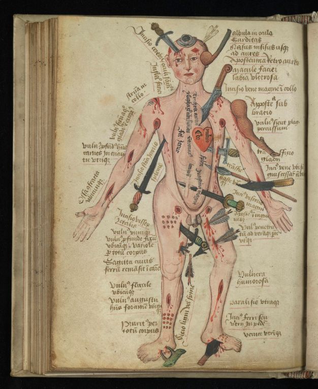 Illumination. A nude, pale-skinned man is poked, stabbed, shot, scraped, and clubbed by swords, daggers, clubs, arrows, thorns, and spears. Red lesions, cuts, or open sores are dotted all over his besieged body. Latin text surrounds the figure.