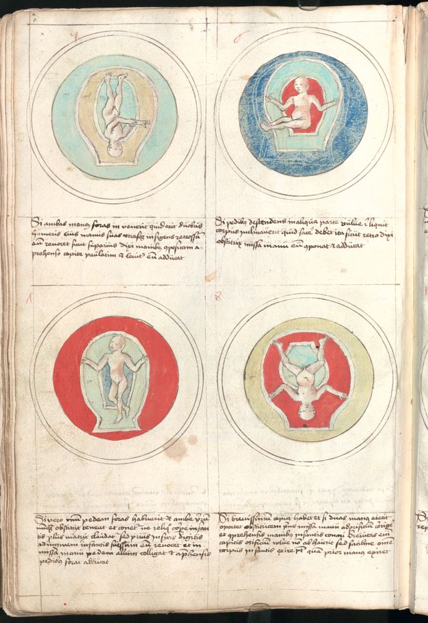 Illumination. Four views of pale-skinned babies in different positions in wombs painted as rings of royal or aqua blue, red, or straw yellow. Several lines of writing are under each image.