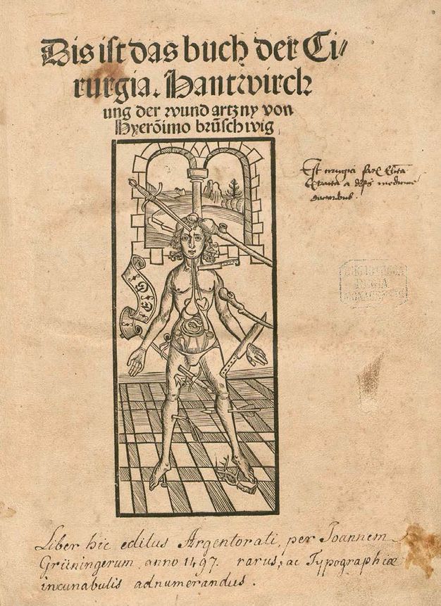 Illustration. This frontispiece for a book consists of a central vignette showing a man poked, sliced, and clubbed by swords, daggers, knives, arrows, and a branch. The skin over his torso is removed to show organs there. He stands on a checkered floor in front of a double window. Text in German is printed above the vignette and a handwritten note is below.