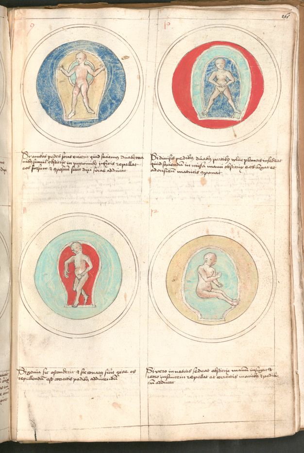 Illumination. Four views of pale-skinned babies in different positions in wombs painted as rings of royal or aqua blue, red, or straw yellow. Two or three lines of writing are under each image.
