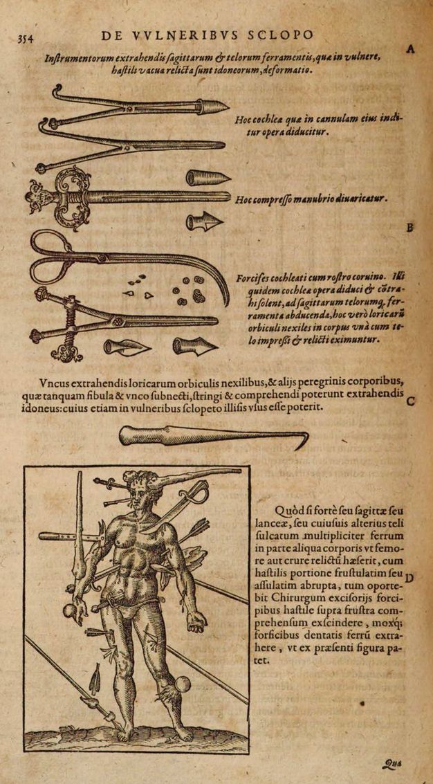Illustration. Instruments used to extract bullets, bullet fragments and arrowheads are lined up in the top half of this page. A man struck and sliced through with daggers, swords, clubs, and other weapons is below.