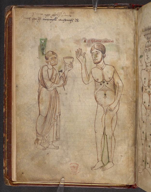 Illumination. A nude man’s body is marked with four dots—one over his belly button and the other three in a triangle at the top of his abdomen under his pectoral muscles. He holds up one hand, and his brows are knit together. A man wearing a robe stands to our left with a bowl and blade-like instrument at the ready.