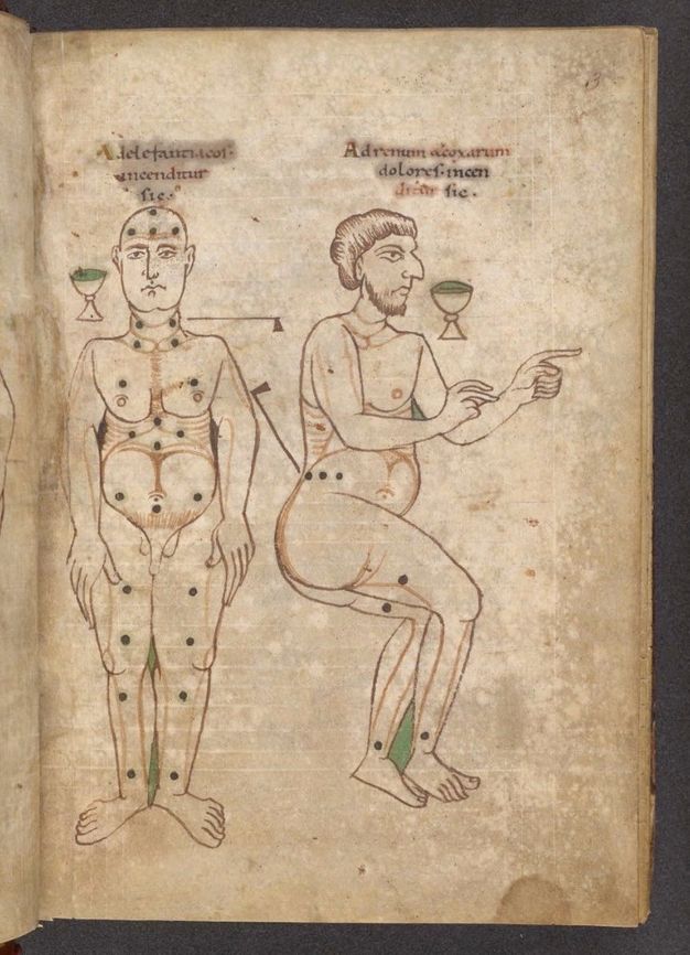 Illumination. Two nude men, one standing and one in a seated posture, have points for bloodletting marked on their bodies with black spots.