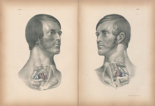 Illustration. On facing pages, the skin over the throat and upper chest of two pale-skinned men has been removed and some vessels painted red and blue. They have similar facial features, including clefts in their chins. They both have mutton chops, but only the mutton chops on the man to our left connect to a moustache.