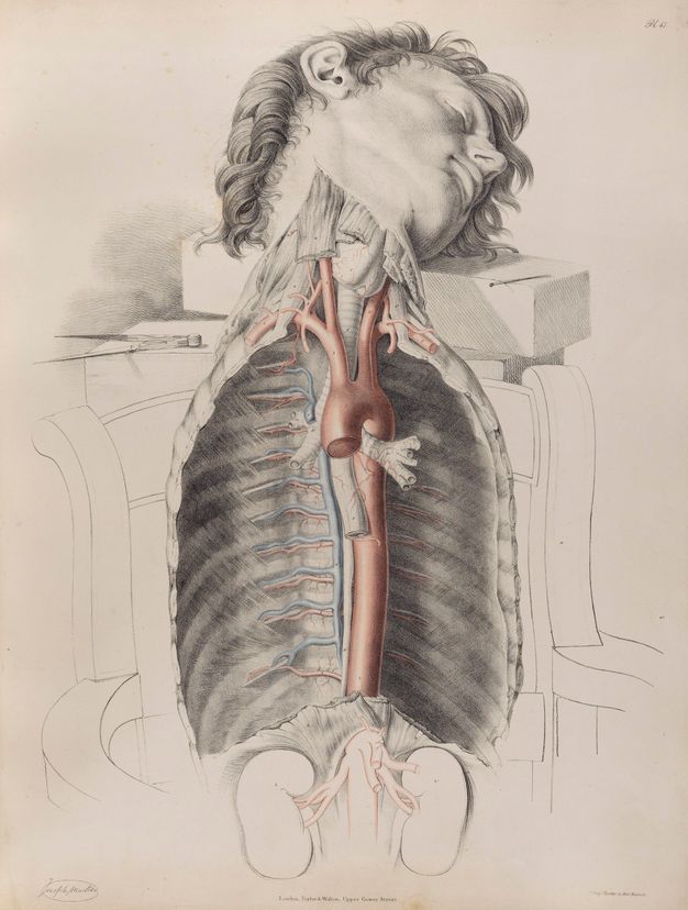 Illustration. A young, clean shaven man’s head rests on a block as the dissected chest cavity seems to rest, as if completely removed from the rest of the body, in the outline of a chair. Tissue and ligaments of the neck have been severed.
