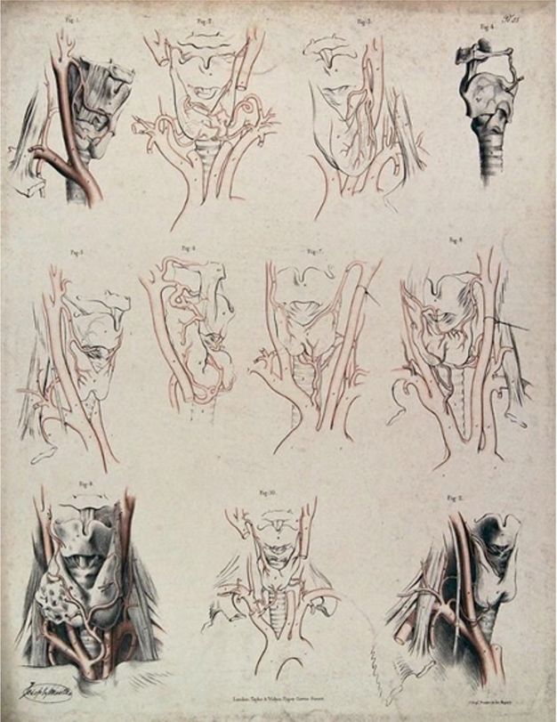 Illustration. Eleven diagrams and illustrations of the organs, vessels, and tissues of the throat and neck. The illustrations in the four corners are shaded in detail. The others are outlined in black and red. No recognizable external body parts, like chins or lips, are present.